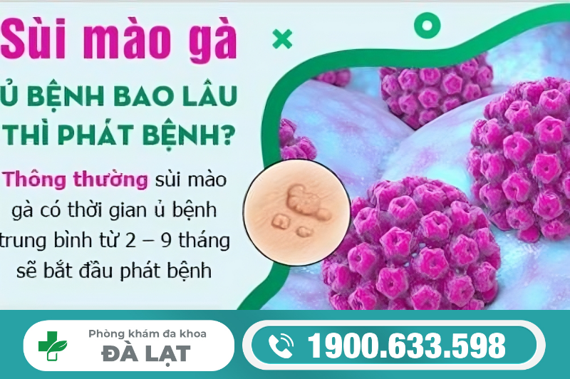 Hình ảnh minh họa